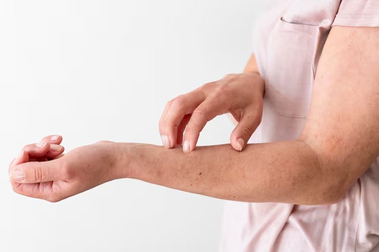 신장이 안 좋으면 나타나는 증상