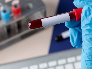 혈액 검사로 알 수 있는 것