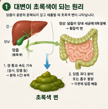 성인-초록색변-복통-원인-설사-냄새-췌장