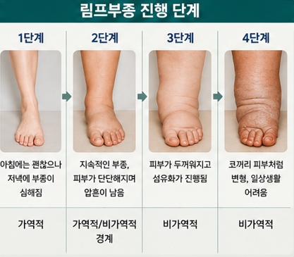 림프부종 단계