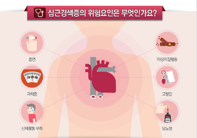 심근경색