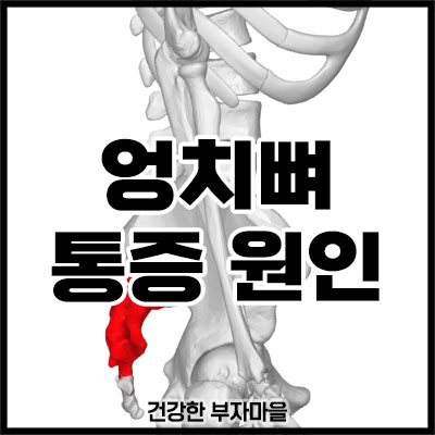 엉치뼈 통증 원인