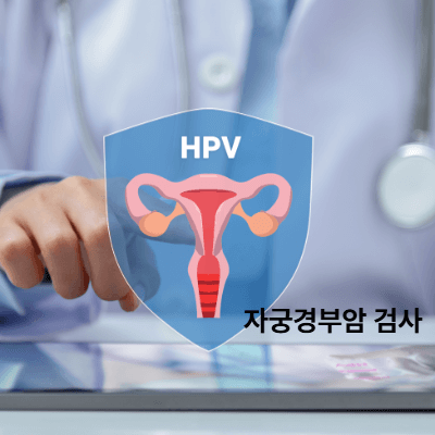 자궁경부암 검사란?