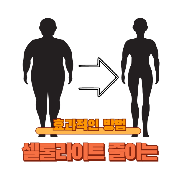 뱃살 셀룰라이트 줄이는 치료법