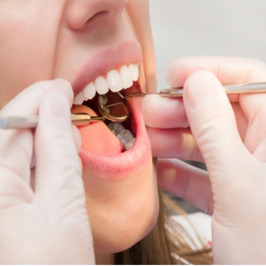 치아-정기-검진