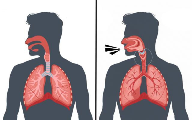 숨쉬기 답답 기침 만성 폐쇄성 폐질환 증상 천명