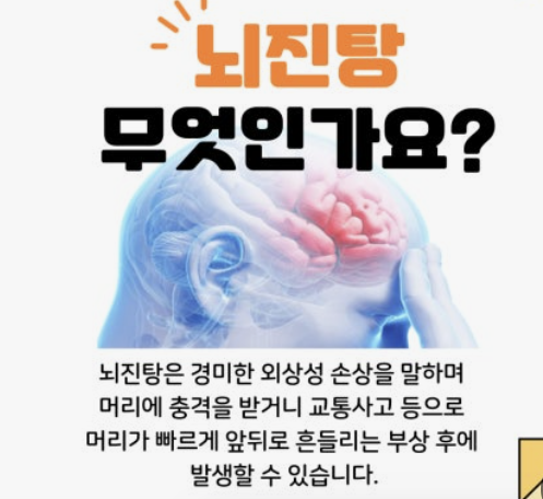 뇌진탕 증상 회복 기간 뇌진탕 제 경험담으로 알려드립니다