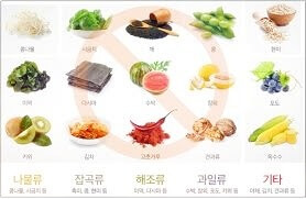 대장내시경 금식 시간