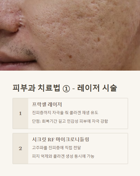 피부과 치료법 레이저 시술