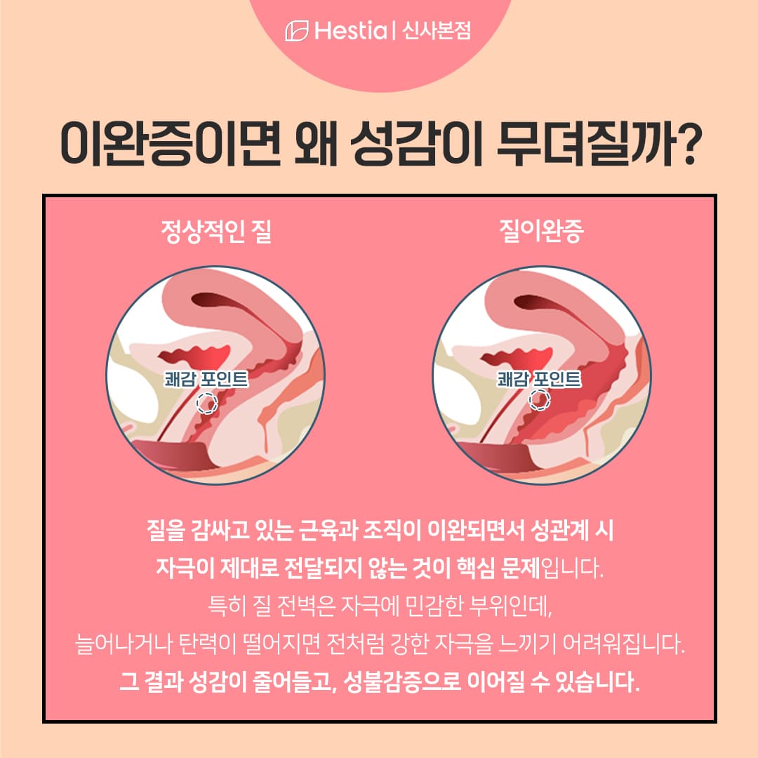 이완증이 성감 저하로 이어지는 이유