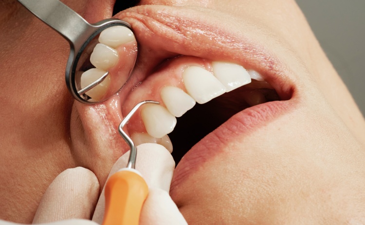 치아 상태를 확인하는 모습