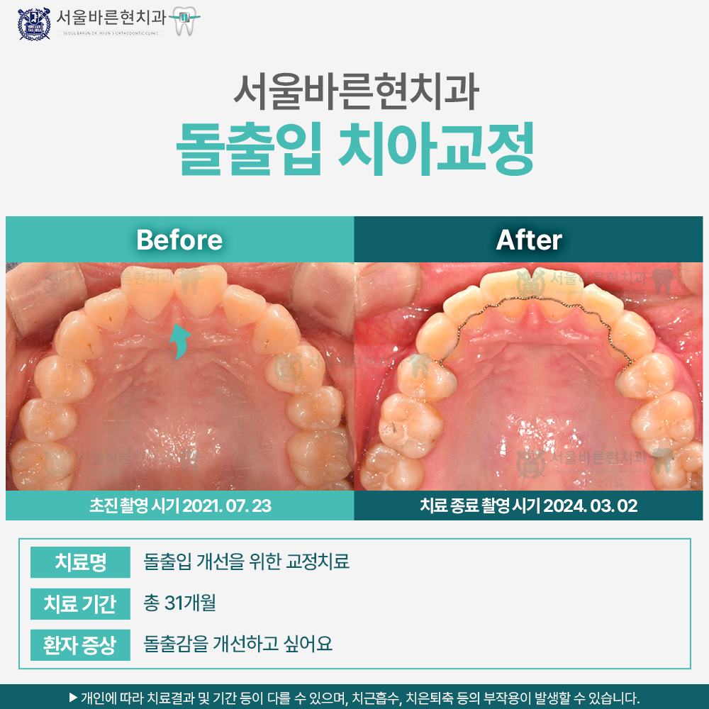 해운대치아교정