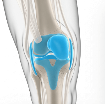 무릎 연골 관리 운동법 추천3