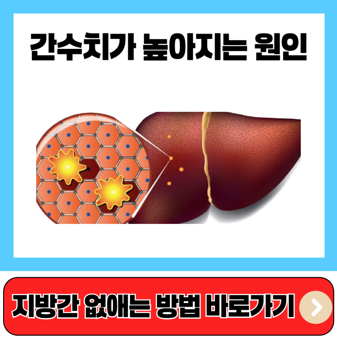 간수치가 높아지는 원인