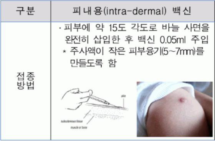 결핵예방접종