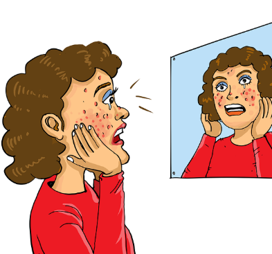 여드름과 색소 침착엔 어떤 걸 사용해야할까?