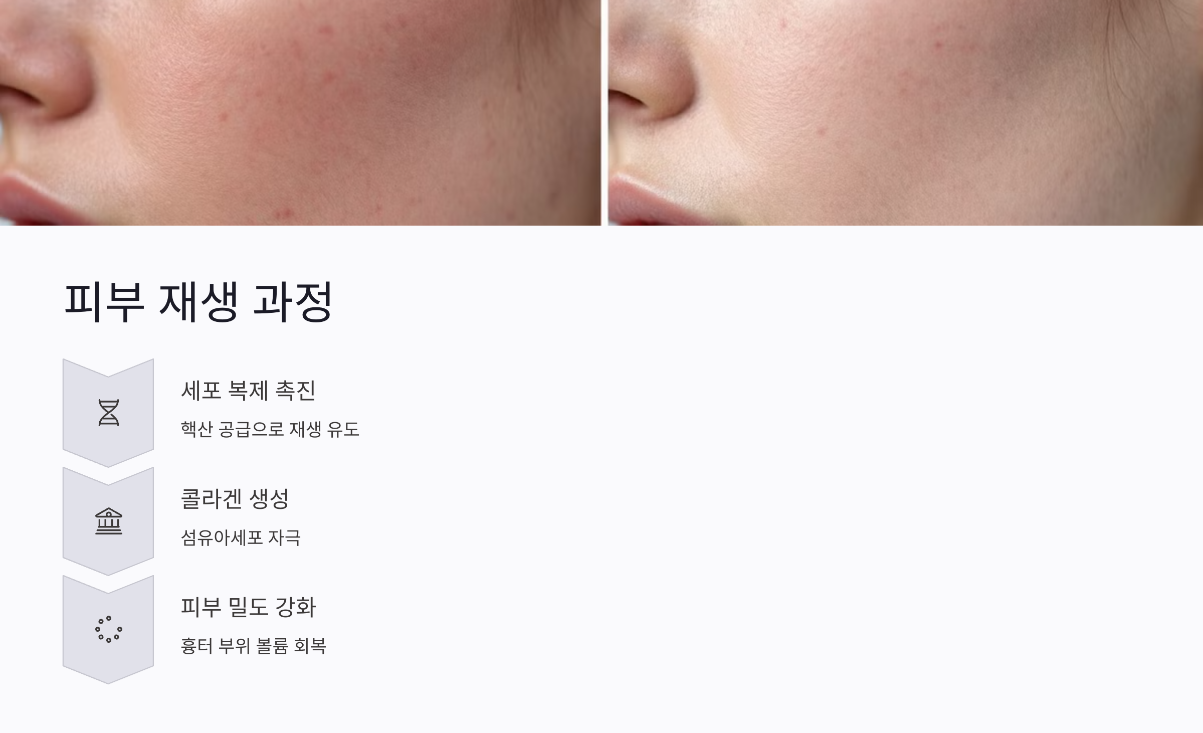 흉터가 회복되는 피부 재생 과정