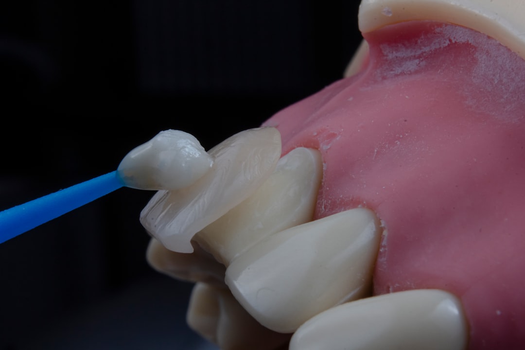 Implant
