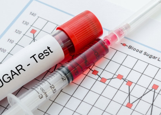 60๋ ํ๋น๊ด๋ฆฌ ์๋ฒฝ ๊ฐ์ด๋ – ์๋จ๋ถํฐ ์ด๋, ์์์ ๊น์ง