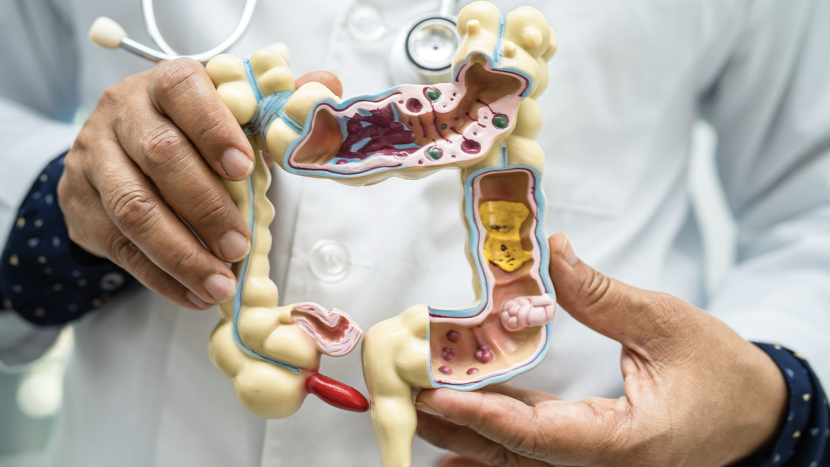흡수장애 (Malabsorption)