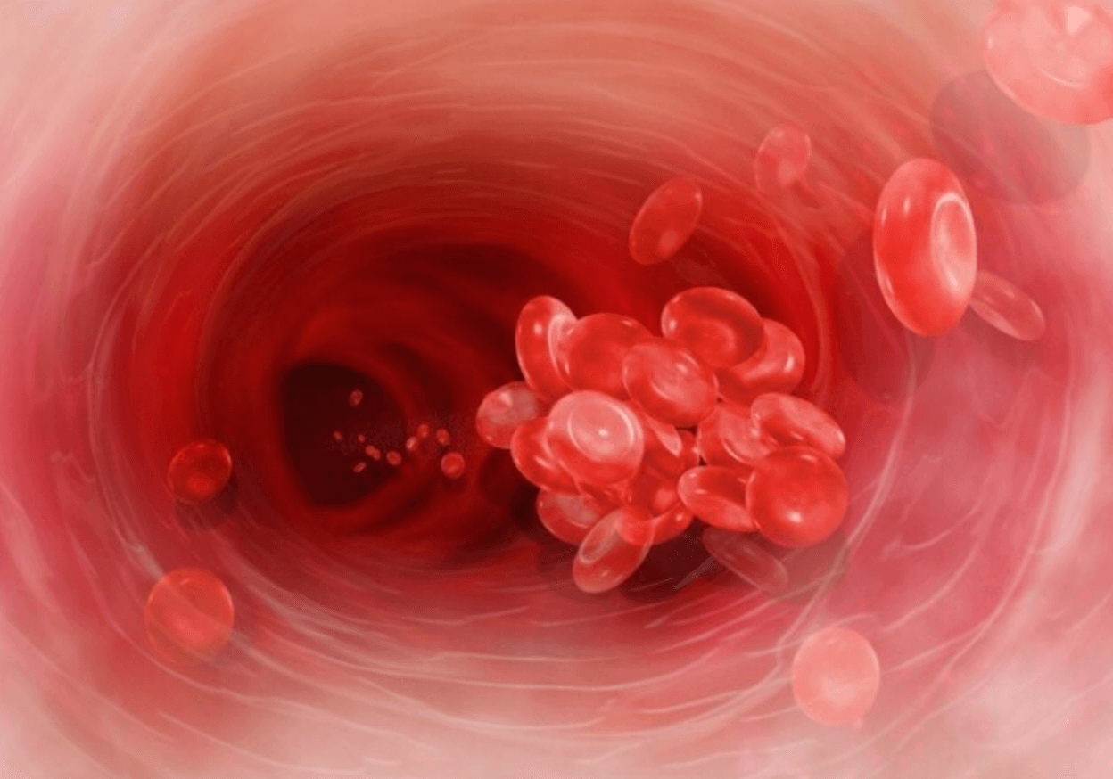 혈액순환-개선-방법