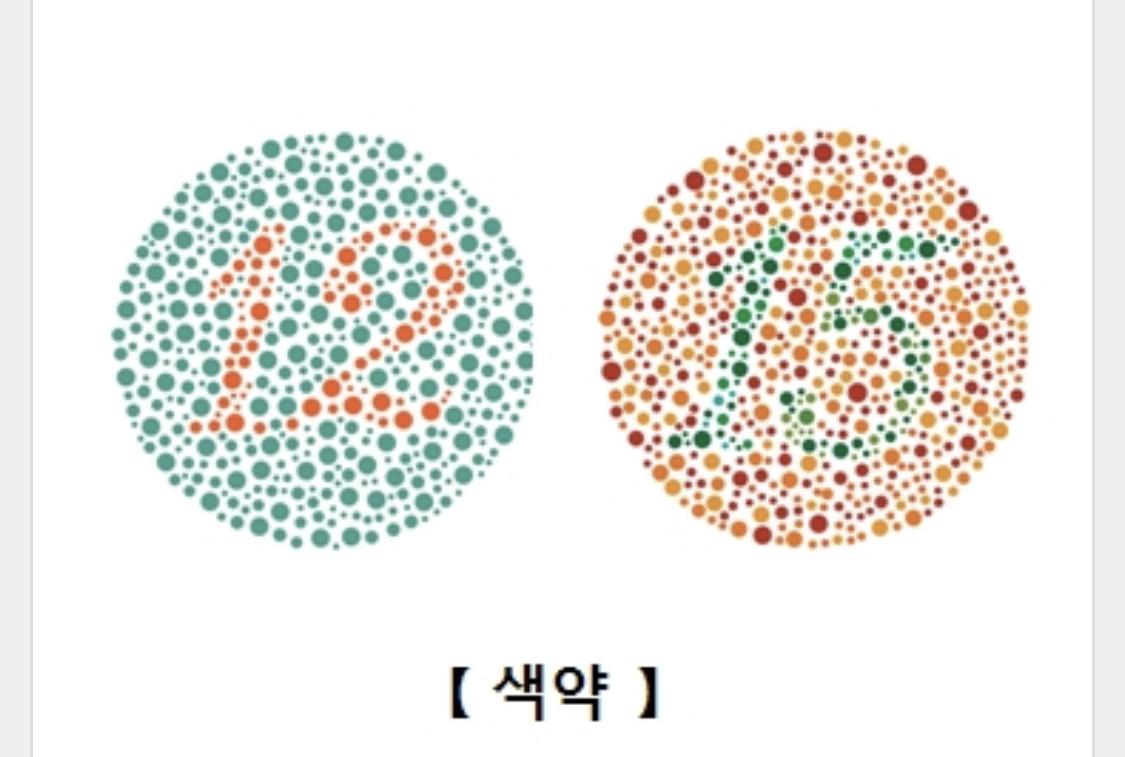 색약 (서울 아산병원 홈페이지)