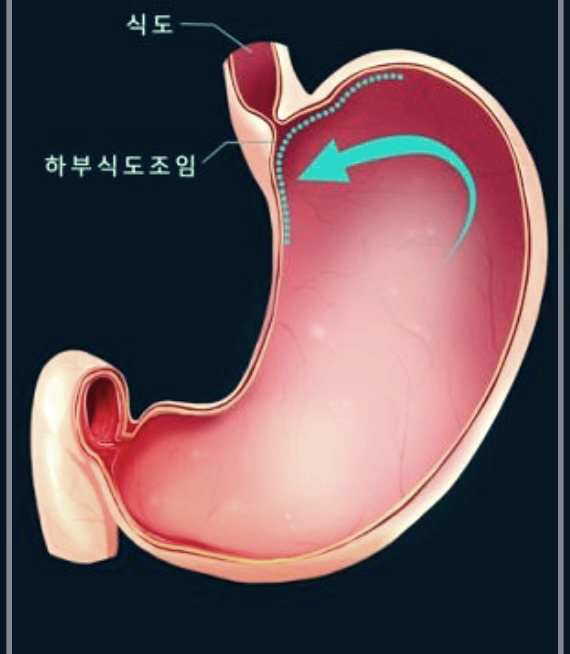 식사 후 바로 누우면 몸에 어떤 변화가?