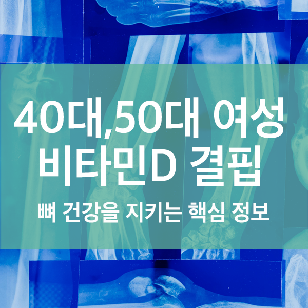 40대, 50대 여성 필수 비타민D 결핍 예방