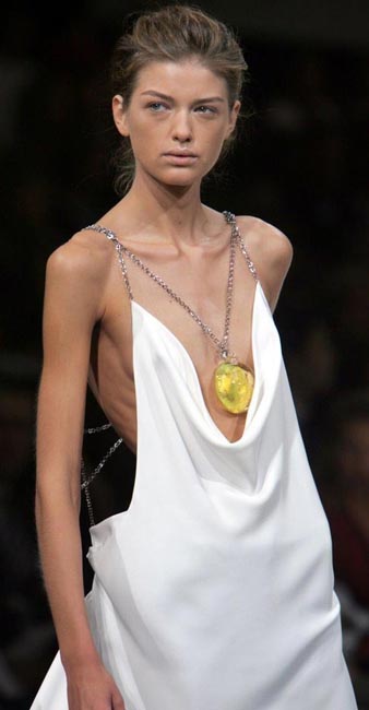 섭식장애 패션 모델