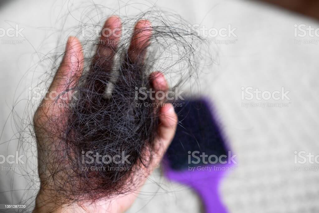 탈모 예방 방법