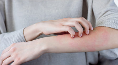 팔이 간지러운 사람