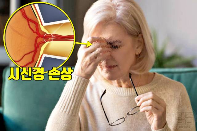 녹내장 원인 녹내장 실명확률 당뇨병 고혈압 심혈관