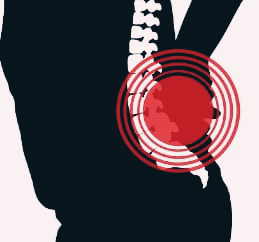 척추관 협착증 운동법과 치료방법