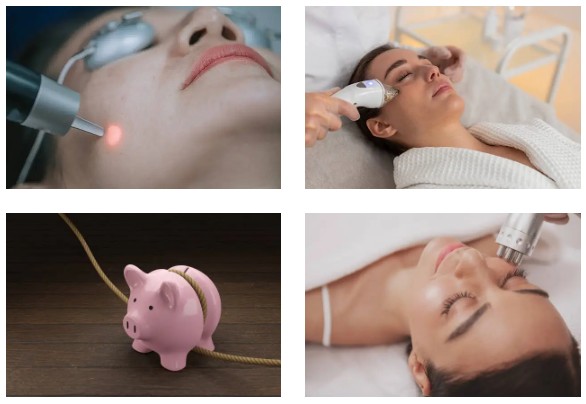 피부 탄력 리프팅 레이저: 울쎄라와 슈링크 시술 비교 분석 (리프팅, 울쎄라, 슈링크)