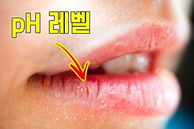 입술 건조 수분 부족 증상 현상, 건강 팁줌 매일꿀정보