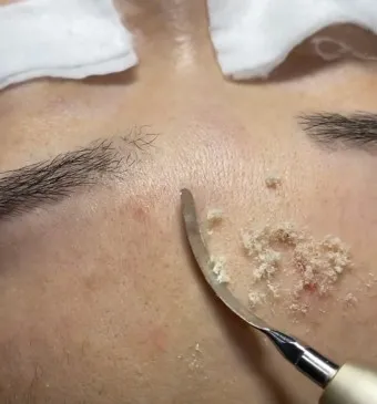 남자 얼굴 피지 제거 화장품 꿀템_21