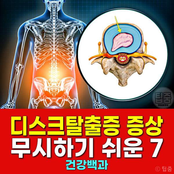 추간판탈출증 증상 디스크탈출증