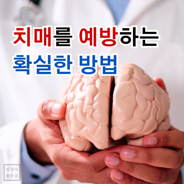 흰 가운을 입은 사람이 뇌 모형을 양손에 들고 치매 예방법 문구가 적힌 정보성 이미지