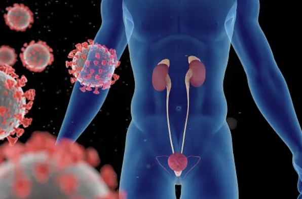 남자 곤지름 증상들 여기 속하면 빨리 치료 해야 하는 이유?