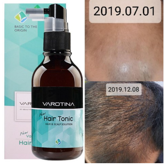 바로티나 탈모양양제 뉴헤어토닉