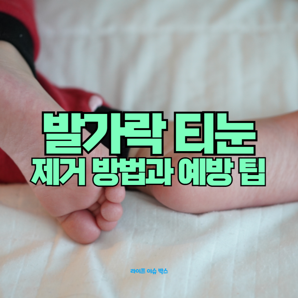 발가락 티눈 제거 방법과 예방 팁