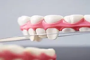 치아