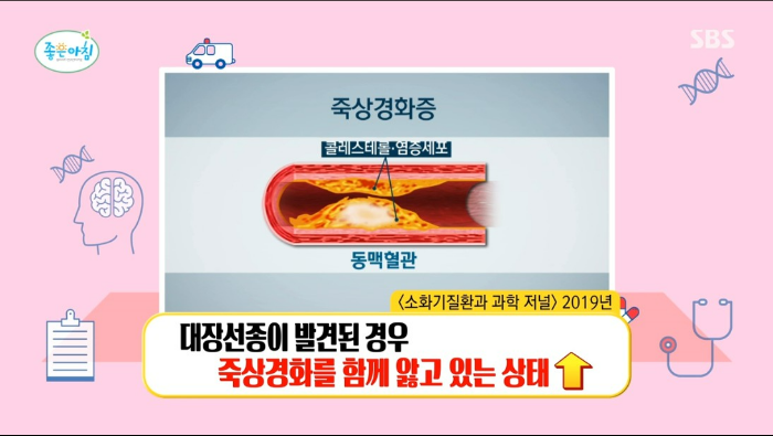 대장암 발병률 1위 잘못된 식습관 