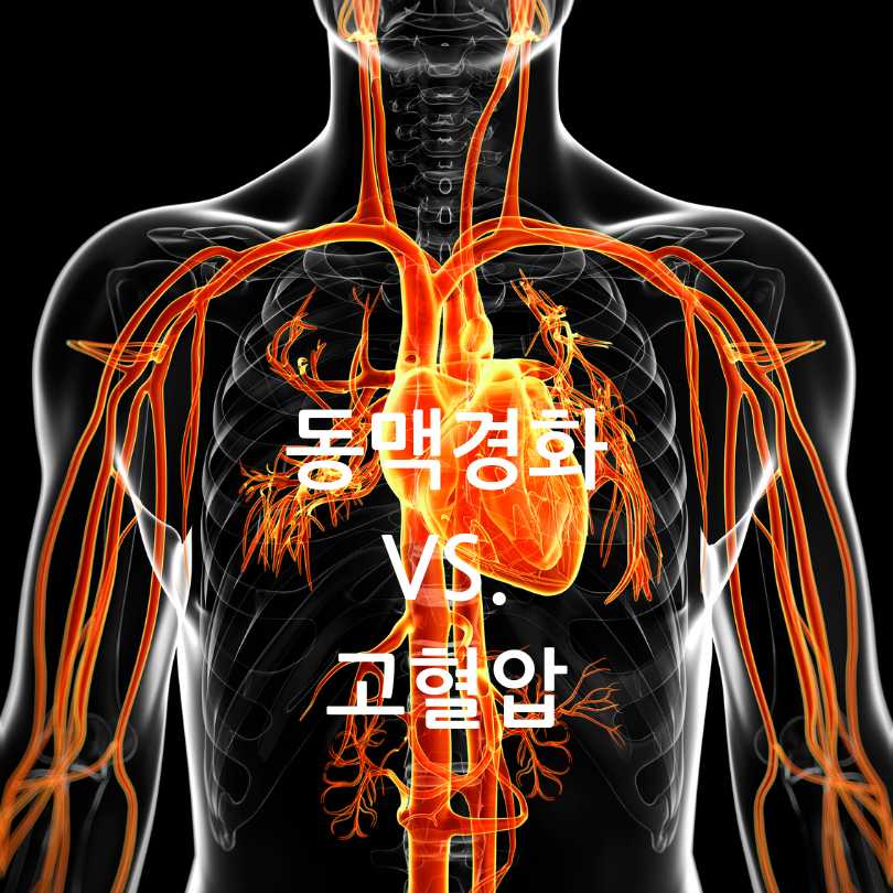 혈관건강관리