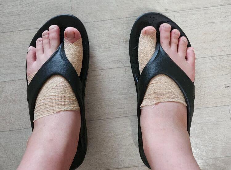 부산무지외반증수술 무지외반깔창 무지외반증 샌들 무지외반증수술병원 무지외반슬리퍼 무지외반증로퍼 무지외반증에 좋은 신발 무지외반증 교정신발 무지외반증 명의 무지외반증정형외과 새끼 발가락 무지외반증 무지외반증 교정기 추천 무지외반증병원추천 무지외반증수술비 무지외반 수술 부산무지외반증 무지외반 신발 무지외반증 보조기 무지외반증 슬리퍼 무지외반 교정기