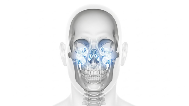 부비동암 얼굴 뼈와 부비동 위치도