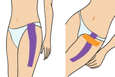 무릎 통증(신경통 원인)