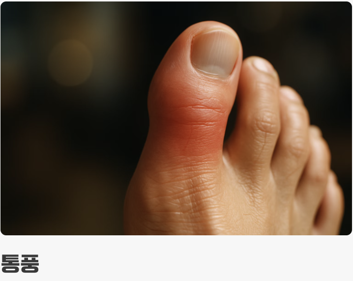 겉모습의 차이&amp;#44; 붉게 부어오름 vs 뼈가 튀어나옴