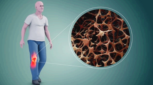 콘드로이친 효능 부작용