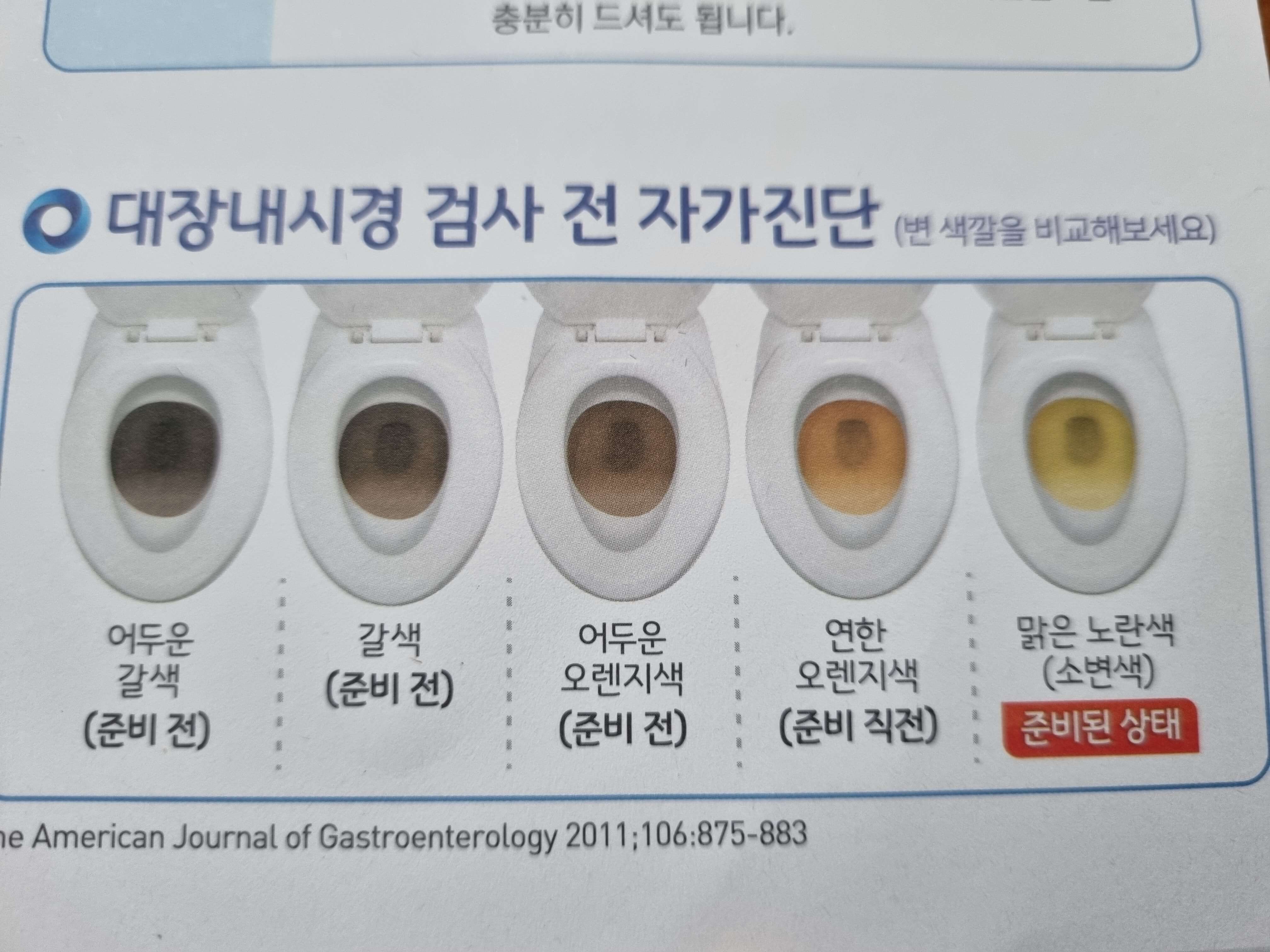 대장내시경 변색상